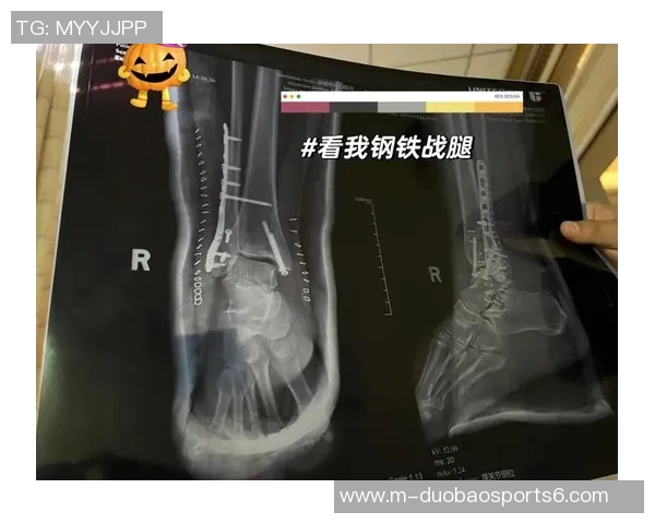 林葳脚踝腓前韧带轻微撕裂预计康复期为一个月的详细分析与建议